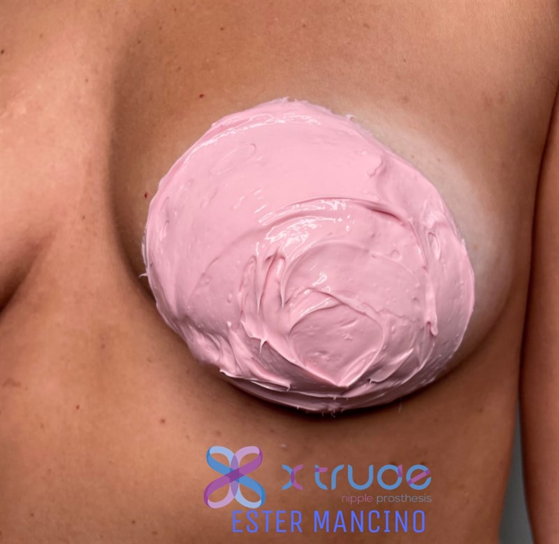 Open day, da donna a donna: donazione speciale calco capezzolo