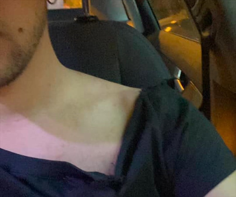maglietta strappata per un attivista di Lega Giovani maglietta strappata per un attivista di Lega Giovani